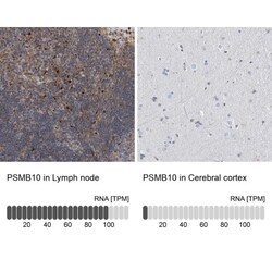 PSMB10/MECL1 Antibody, Novus Biologicals 25 &mu;L, Unlabeled:Antibodies,