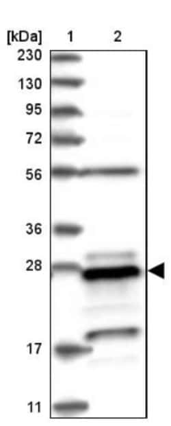PSMB10/MECL1 Antibody, Novus Biologicals:Antibodies:Primary Antibodies