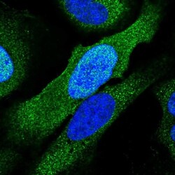 PSMC6 Antibody, Novus Biologicals 25 &mu;L, Unlabeled:Antibodies, Polyclonal