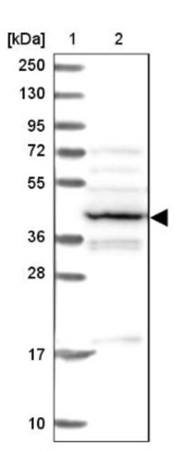 PSMC6 Antibody, Novus Biologicals 25 &mu;L, Unlabeled:Antibodies, Polyclonal
