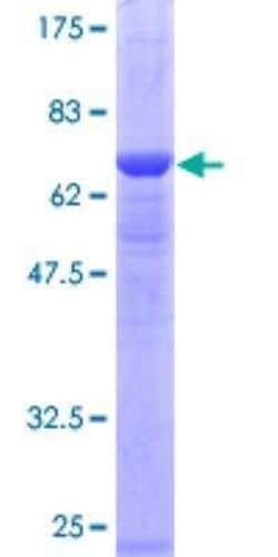 Novus Biologicals Recombinant Human PSMC6 GST (N-Term) Protein 10 &mu;g | Buy Online | Novus Biologicals&trade; | Fisher Scientific