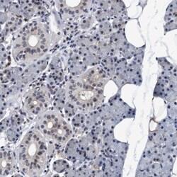 PSMD12 Antibody, Novus Biologicals 25 &mu;L | Buy Online | Novus Biologicals | Fisher Scientific