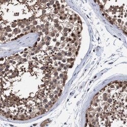 PSMD12 Antibody, Novus Biologicals 25 &mu;L | Buy Online | Novus Biologicals | Fisher Scientific