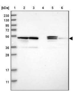 PSMD12 Antibody, Novus Biologicals 25 &mu;L | Buy Online | Novus Biologicals | Fisher Scientific