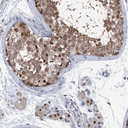 PSMD13 Antibody, Novus Biologicals 25 &mu;L, Unlabeled:Antibodies, Polyclonal