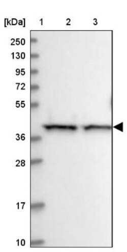 PSMD13 Antibody, Novus Biologicals 25 &mu;L, Unlabeled:Antibodies, Polyclonal