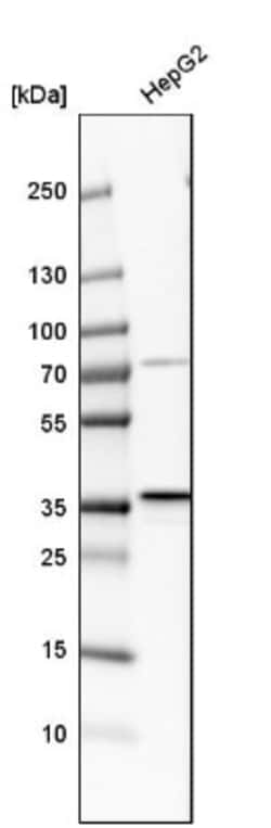 PSMD14 Antibody, Novus Biologicals:Antibodies:Primary Antibodies