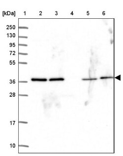 PSMD7 Antibody, Novus Biologicals 25 &mu;L, Unlabeled:Antibodies, Polyclonal