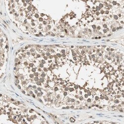 PSMD8 Antibody, Novus Biologicals 0.1mL; Unlabeled:Antibodies, Polyclonal
