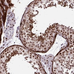 PSME4 Antibody, Novus Biologicals:Antibodies:Primary Antibodies