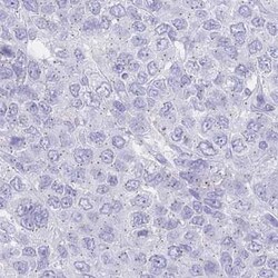 PSORS1C2 Antibody, Novus Biologicals 0.1mL; Unlabeled:Antibodies, Polyclonal