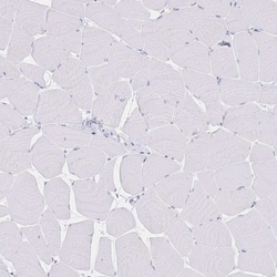 PSORS1C2 Antibody, Novus Biologicals 0.1mL; Unlabeled:Antibodies, Polyclonal