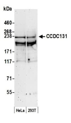 PSRC2 Antibody, Novus Biologicals 0.1mL; Unlabeled:Antibodies, Polyclonal