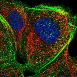 PSTK Antibody, Novus Biologicals 25 &mu;L; Unlabeled:Antibodies, Polyclonal