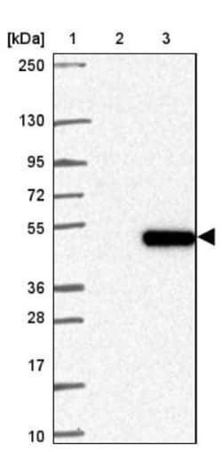 PSTK Antibody, Novus Biologicals 25 &mu;L; Unlabeled:Antibodies, Polyclonal