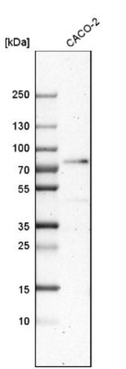 PTCD1 Antibody, Novus Biologicals:Antibodies:Primary Antibodies
