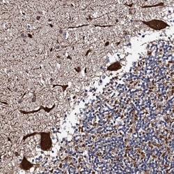 PTCD3 Antibody, Novus Biologicals:Antibodies:Primary Antibodies
