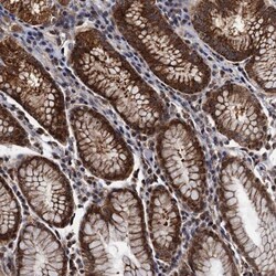 PTCD3 Antibody, Novus Biologicals 0.1mL; Unlabeled:Antibodies, Polyclonal