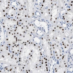 PTDSS1 Antibody, Novus Biologicals 25 &mu;L; Unlabeled:Antibodies, Polyclonal