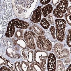 PTER Antibody, Novus Biologicals:Antibodies:Primary Antibodies