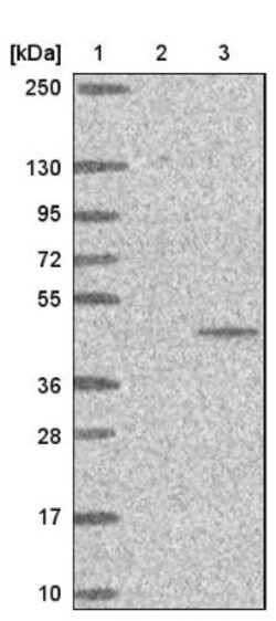PTER Antibody, Novus Biologicals 25 &mu;L; Unlabeled:Antibodies, Polyclonal