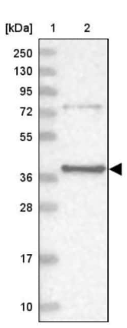 PTER Antibody, Novus Biologicals:Antibodies:Primary Antibodies