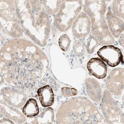 anti-PTGER4/EP4, Polyclonal, Novus Biologicals 0.1mL; Unlabeled:Antibodies,