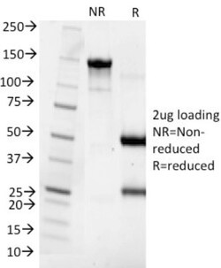 PTH Antibody (3H9) - N-terminal, Novus Biologicals 0.2mg; Unlabeled:Antibodies,