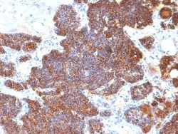 PTH Antibody (PTH/1174) - C-terminus, Novus Biologicals 0.2mg; Unlabeled:Antibodies,