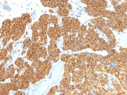 PTH Antibody (PTH/911) - N-terminal, Novus Biologicals 0.2mg; Unlabeled:Antibodies,