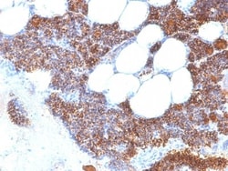PTH Antibody (SPM604) - N-terminal, Novus Biologicals 0.2mg; Unlabeled:Antibodies,