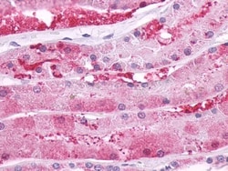 PTH1R/PTHR1 Antibody - BSA Free, Novus Biologicals 0.05 mL | Buy Online | Novus Biologicals | Fisher Scientific