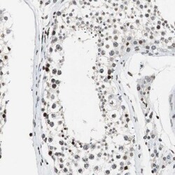 PTIP Antibody, Novus Biologicals:Antibodies:Primary Antibodies