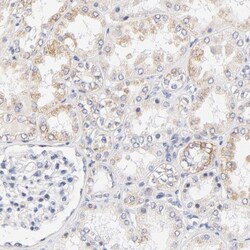 PTK7/CCK4 Antibody, Novus Biologicals:Antibodies:Primary Antibodies