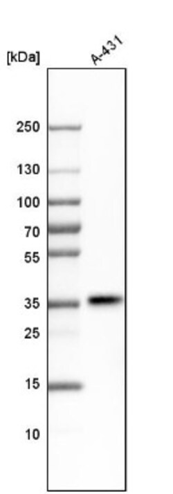 PTK9 Antibody, Novus Biologicals 25 &mu;L | Buy Online | Novus Biologicals | Fisher Scientific