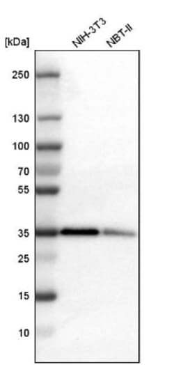 PTK9 Antibody, Novus Biologicals 25 &mu;L | Buy Online | Novus Biologicals | Fisher Scientific