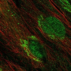 PTOP Antibody, Novus Biologicals 0.1mL; Unlabeled:Antibodies, Polyclonal