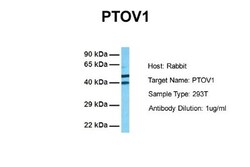 PTOV1 Antibody, Novus Biologicals 0.05mg; Unlabeled:Antibodies, Polyclonal