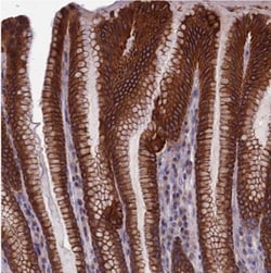 PTP-MEG2/PTPN9 Antibody, Novus Biologicals 0.1mL; Unlabeled:Antibodies,