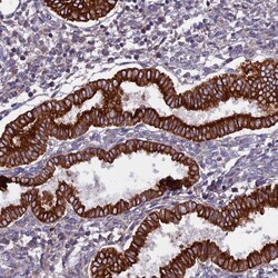 PTP-MEG2/PTPN9 Antibody, Novus Biologicals 0.1mL; Unlabeled:Antibodies,