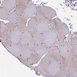 PTP-MEG2/PTPN9 Antibody, Novus Biologicals 0.1mL; Unlabeled:Antibodies,