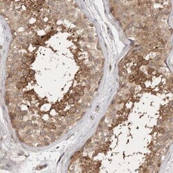 PTPDC1 Antibody, Novus Biologicals:Antibodies:Primary Antibodies