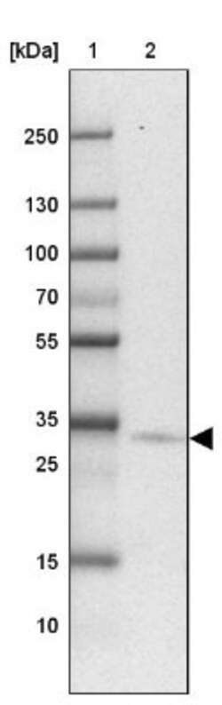 PTPLAD2 Antibody, Novus Biologicals 0.1mL; Unlabeled:Antibodies, Polyclonal