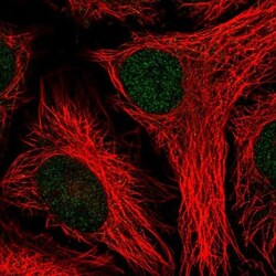 PTPN14/PTPD2 Antibody, Novus Biologicals 0.1mL; Unlabeled:Antibodies, Polyclonal