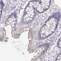 PTPN14/PTPD2 Antibody, Novus Biologicals 0.1mL; Unlabeled:Antibodies, Polyclonal