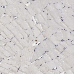 SHP-1 Antibody, Novus Biologicals 25 &mu;L; Unlabeled:Antibodies, Polyclonal