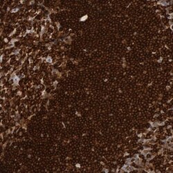 SHP-1 Antibody, Novus Biologicals 25 &mu;L; Unlabeled:Antibodies, Polyclonal