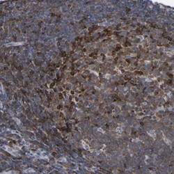 PTPN7 Antibody, Novus Biologicals 0.1mL; Unlabeled:Antibodies, Polyclonal