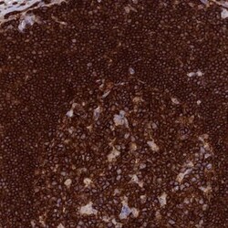 PTPRCAP Antibody, Novus Biologicals 0.1mL; Unlabeled:Antibodies, Polyclonal