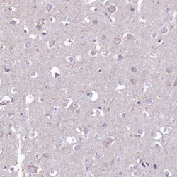 PTPRCAP Antibody, Novus Biologicals 0.1mL; Unlabeled:Antibodies, Polyclonal